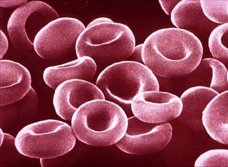 Hemoglobin 7 Düşüklüğü Belirtileri